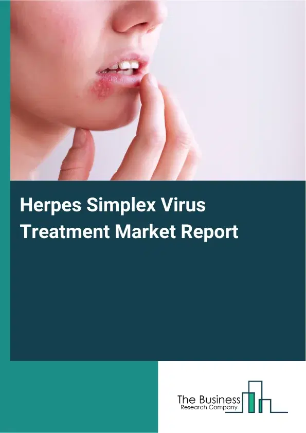 Global Herpes Simplex Virus Treatment Market Report 2026