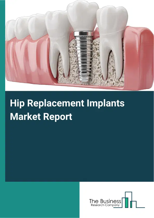Global Hip Replacement Implants Market Report 2026