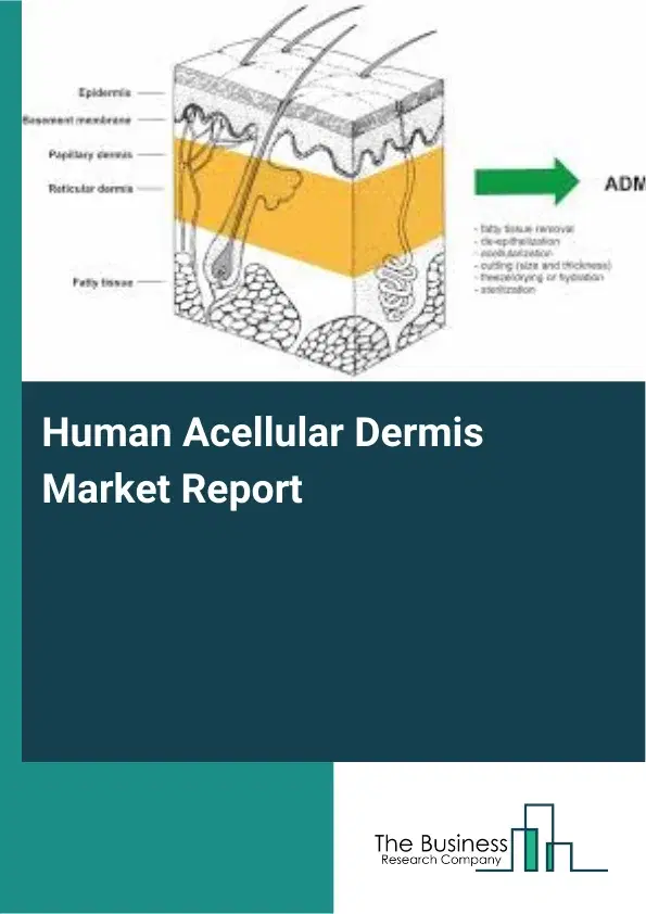 Global Human Acellular Dermis Market Report 2026