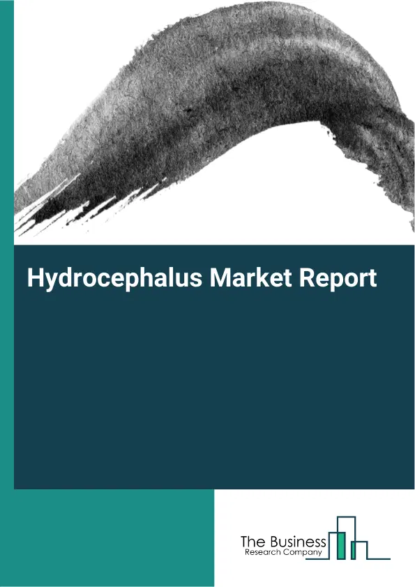 Global Hydrocephalus Market Report 2026