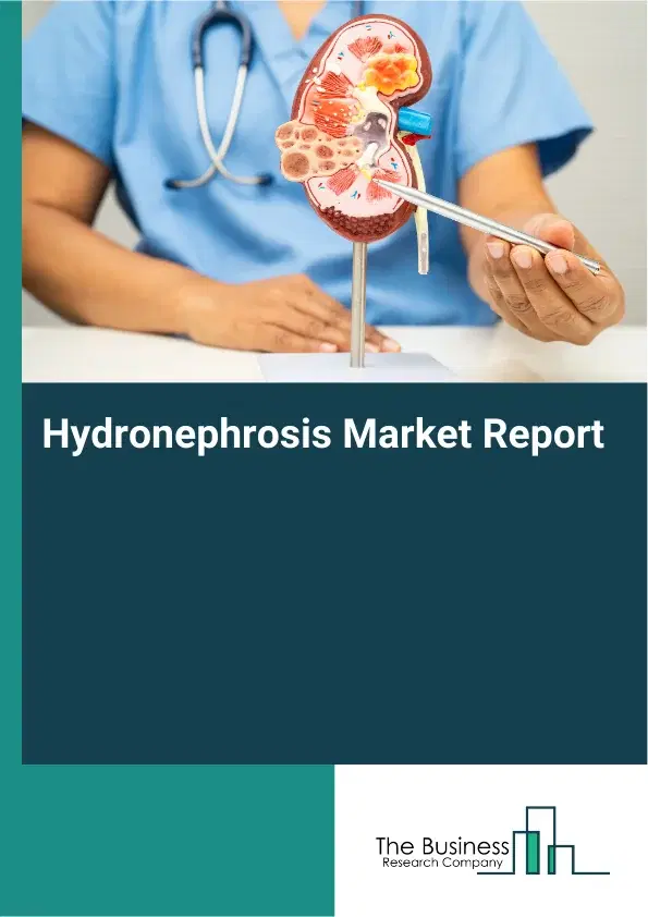 Global Hydronephrosis Market Report 2026
