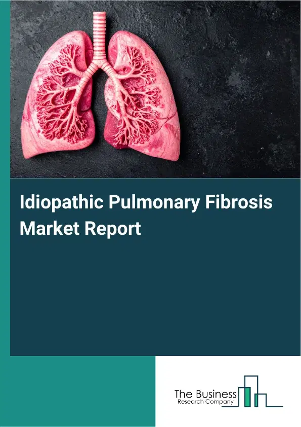 Global Idiopathic Pulmonary Fibrosis Market Report 2026