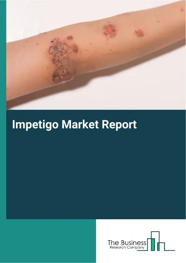 Global Impetigo Market Report 2026