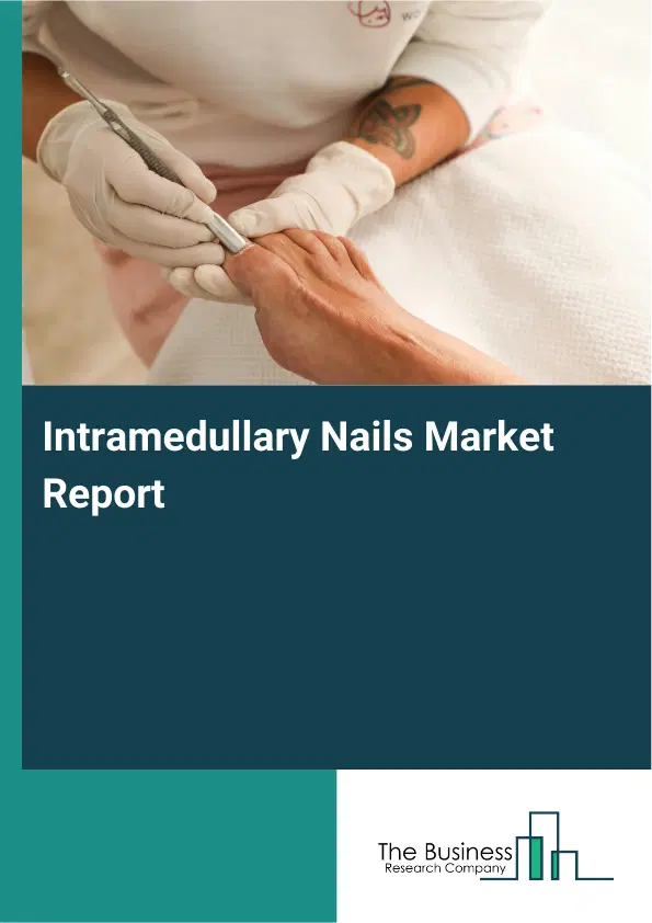 Global Intramedullary Nails Market Report 2026