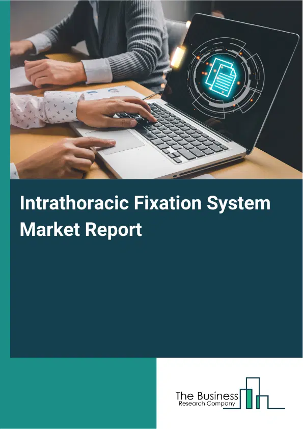 Global Intrathoracic Fixation System Market Report 2026