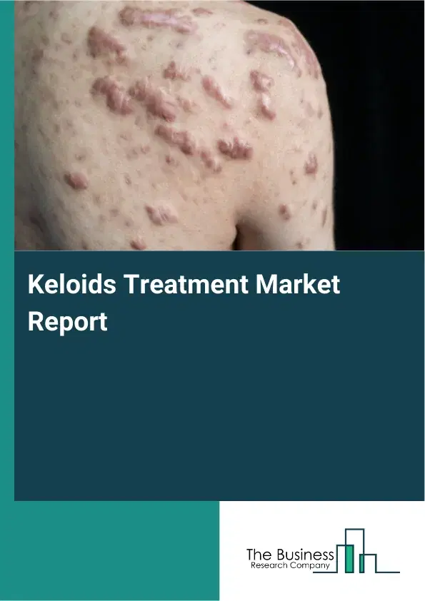 Global Keloids Treatment Market Report 2026