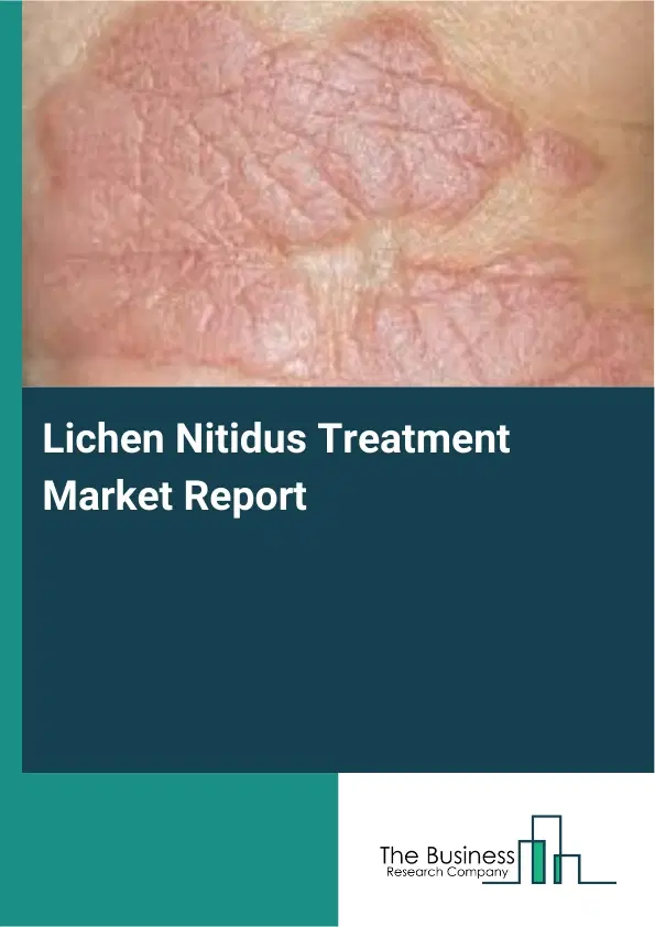 Global Lichen Nitidus Treatment Market Report 2026