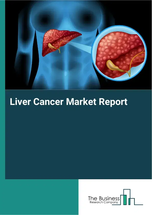 Global Liver Cancer Market Report 2026