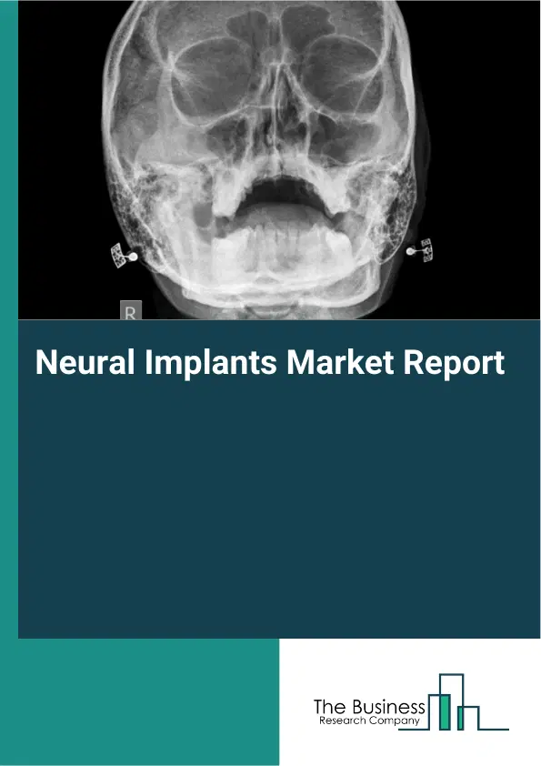Global Neural Implants Market Report 2026