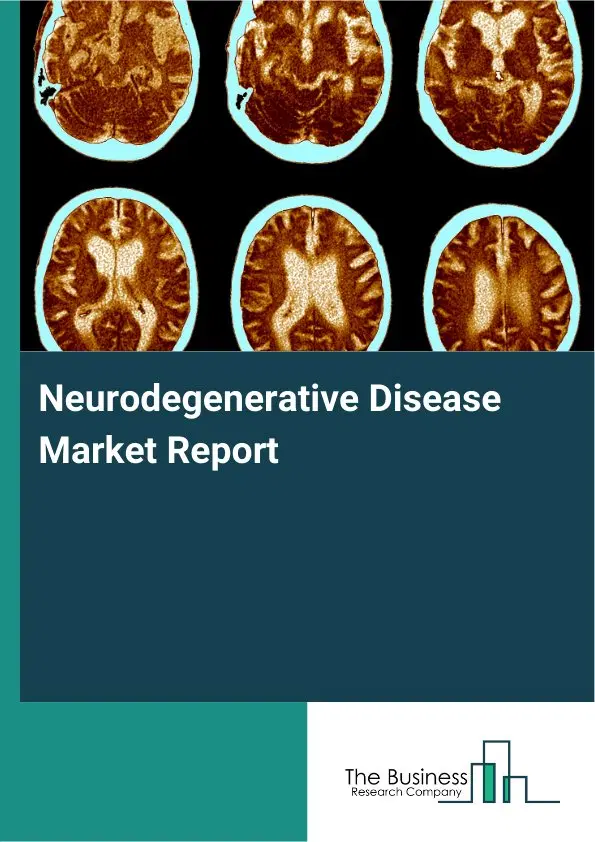 Global Neurodegenerative Disease Market Report 2026