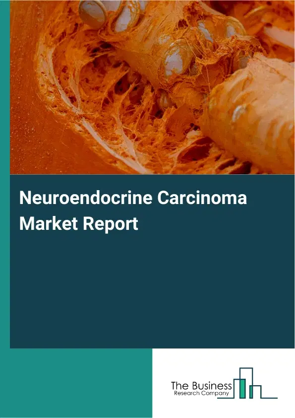 Global Neuroendocrine Carcinoma Market Report 2026