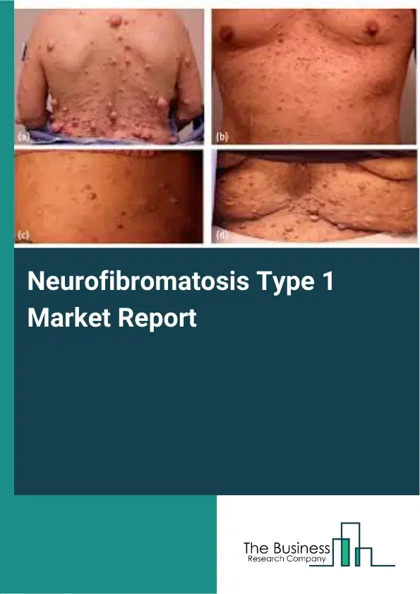 Global Neurofibromatosis Type 1 Market Report 2026