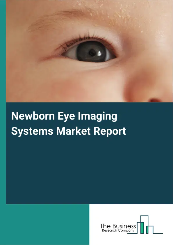 Global Newborn Eye Imaging Systems Market Report 2026