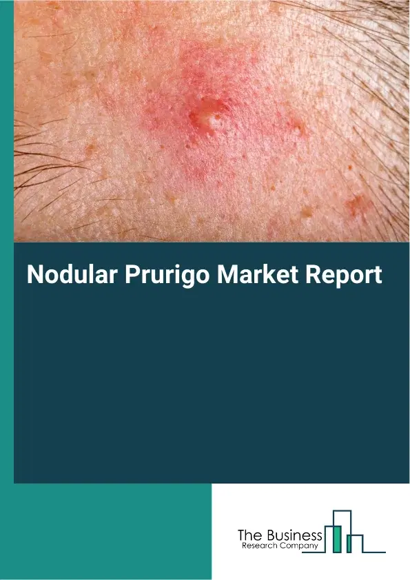 Global Nodular Prurigo Market Report 2026