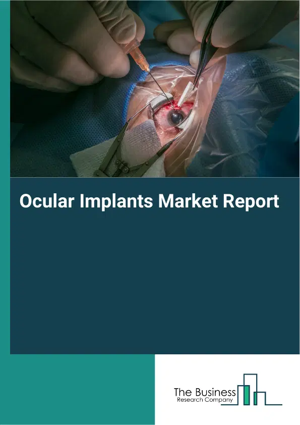 Global Ocular Implants Market Report 2026