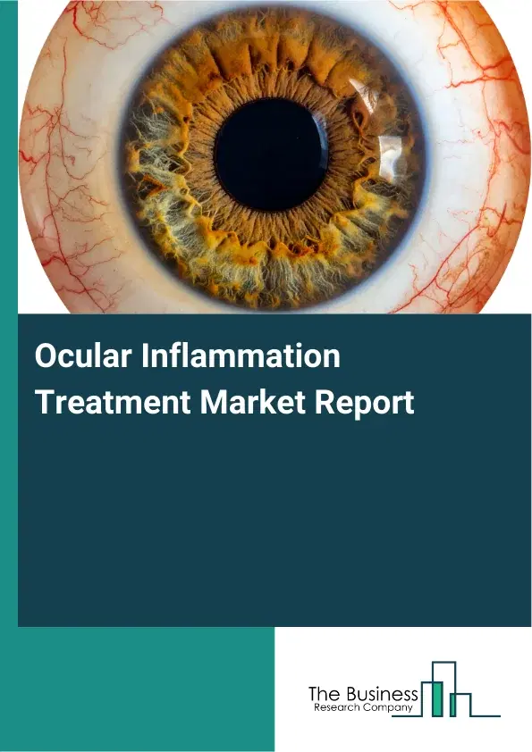 Global Ocular Inflammation Treatment Market Report 2026