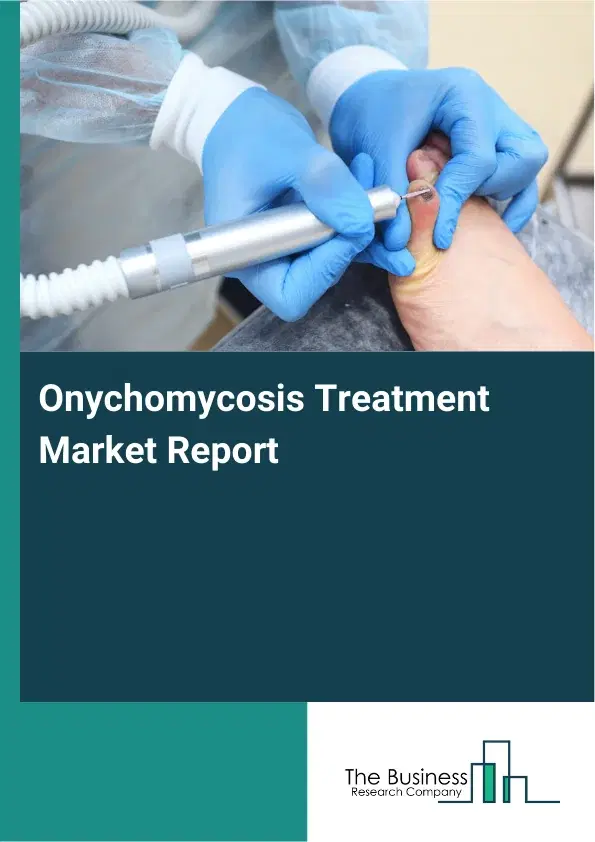 Global Onychomycosis Treatment Market Report 2026