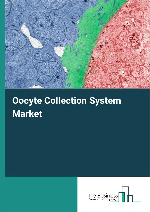 Oocyte Collection System Market Report 2026