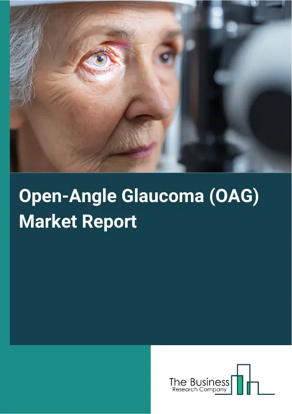 Global Open-Angle Glaucoma (OAG) Market Report 2026