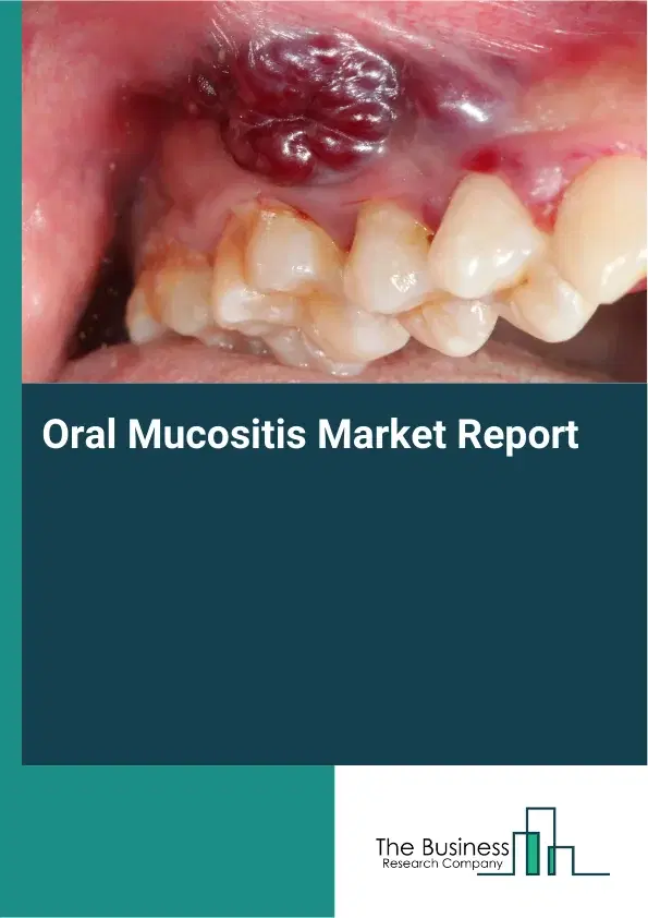 Global Oral Mucositis Market Report 2026