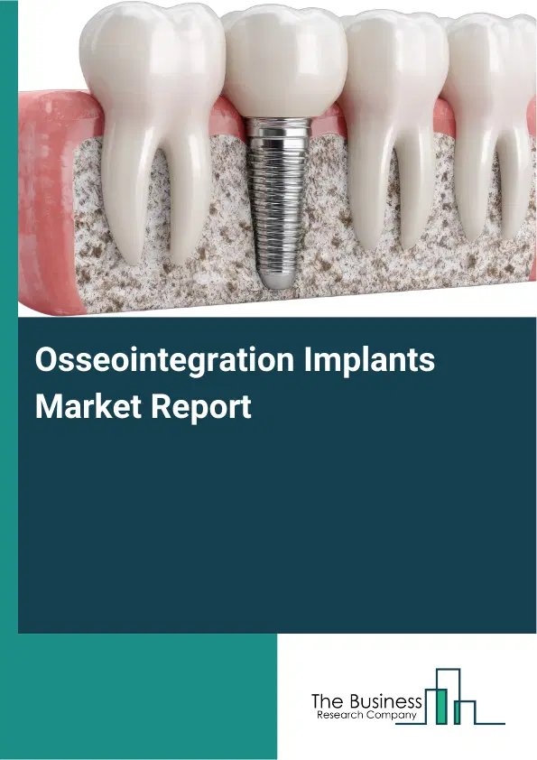 Global Osseointegration Implants Market Report 2026