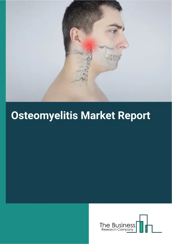 Global Osteomyelitis Market Report 2026