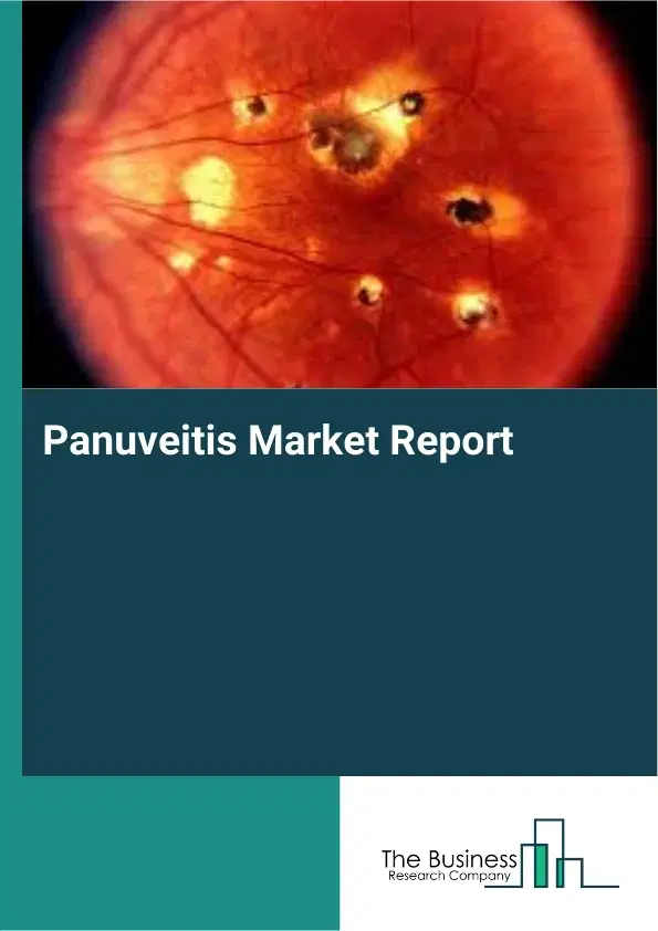 Global Panuveitis Market Report 2026