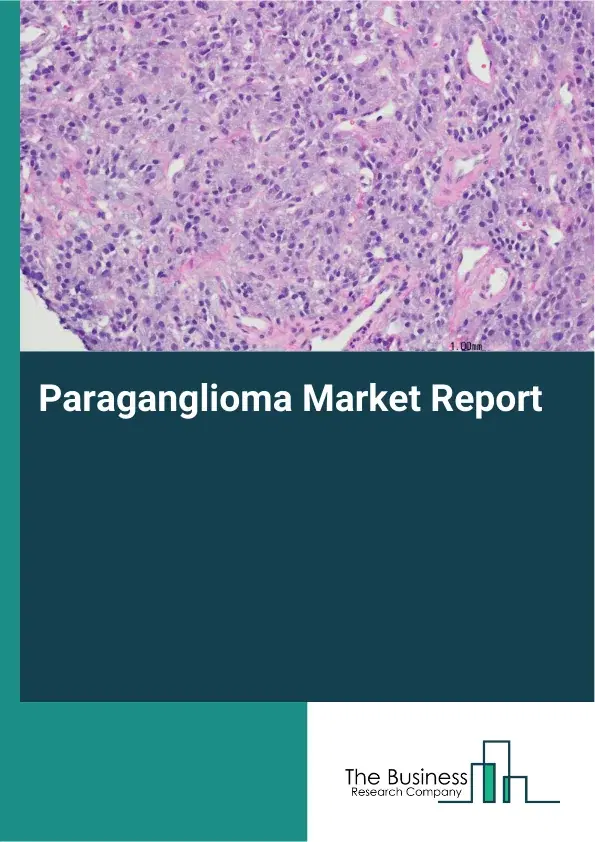 Global Paraganglioma Market Report 2026