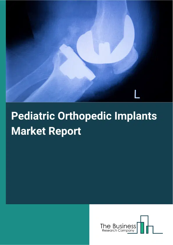Global Pediatric Orthopedic Implants Market Report 2026