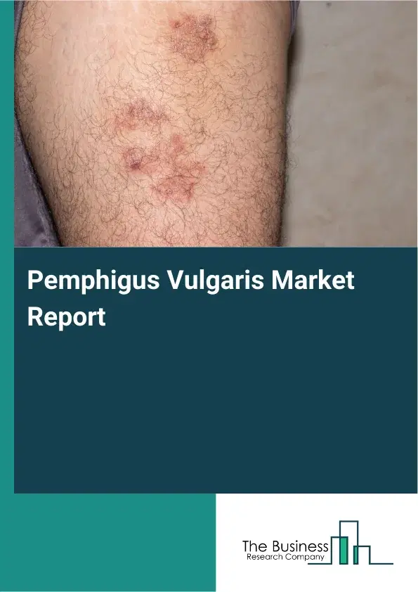 Global Pemphigus Vulgaris Market Report 2026