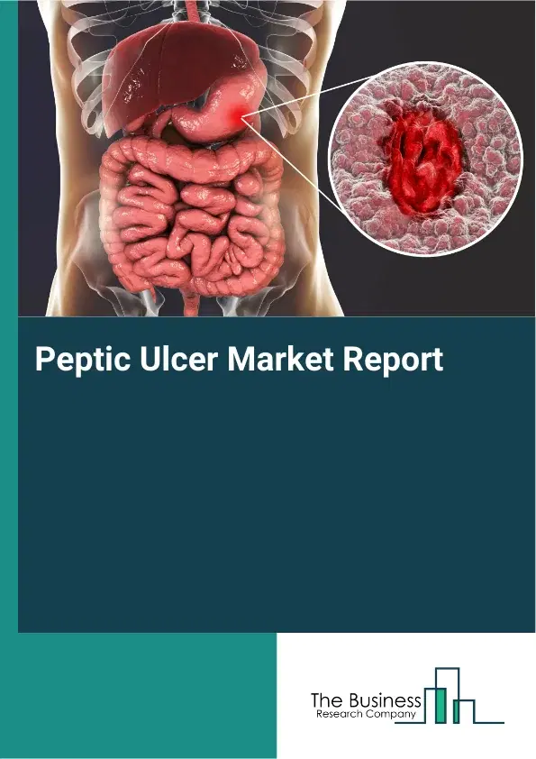 Global Peptic Ulcer Market Report 2026