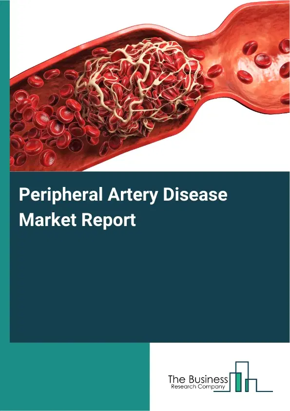 Global Peripheral Artery Disease Market Report 2026