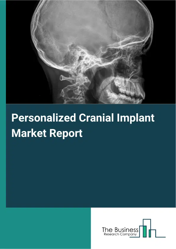 Global Personalized Cranial Implant Market Report 2026