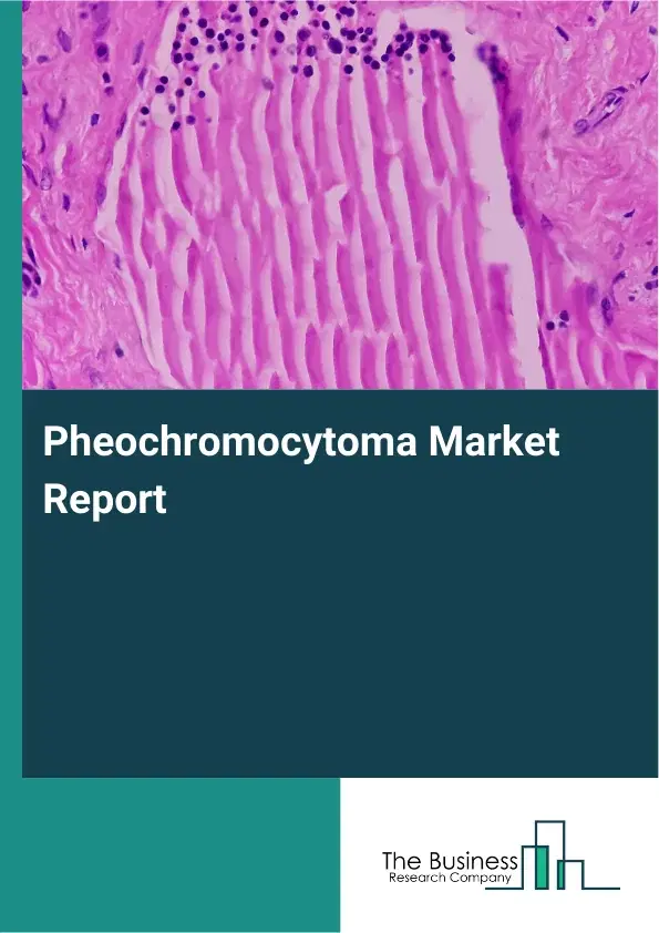 Global Pheochromocytoma Market Report 2026