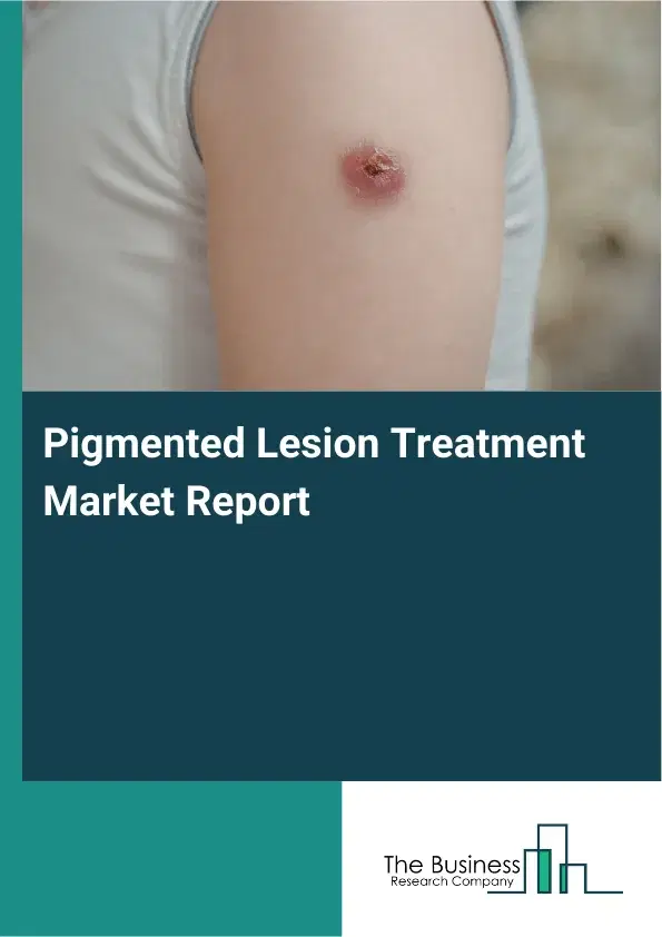 Global Pigmented Lesion Treatment Market Report 2026