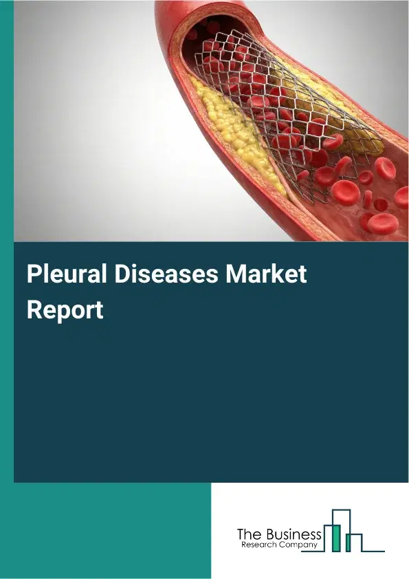Global Pleural Diseases Market Report 2026