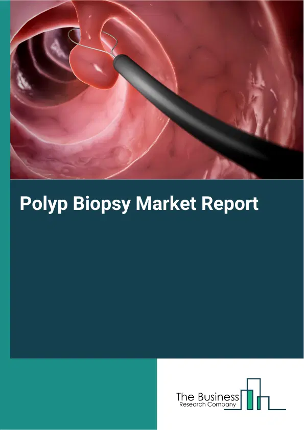 Global Polyp Biopsy Market Report 2026