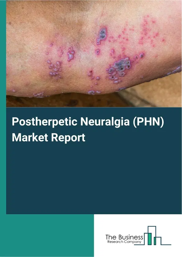 Global Postherpetic Neuralgia (PHN) Market Report 2026