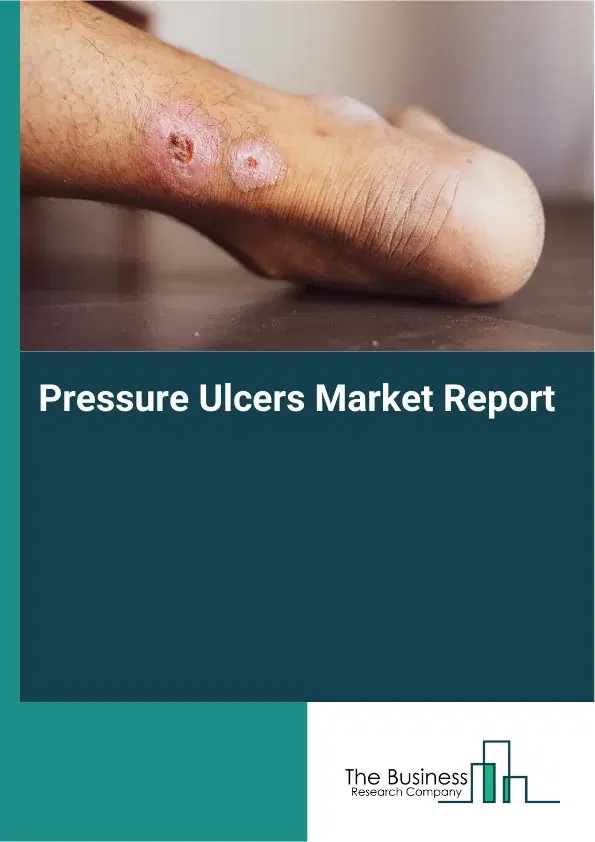 Global Pressure Ulcers Market Report 2026