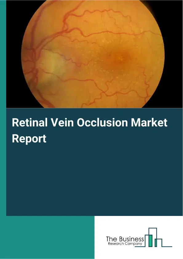 Global Retinal Vein Occlusion Market Report 2026