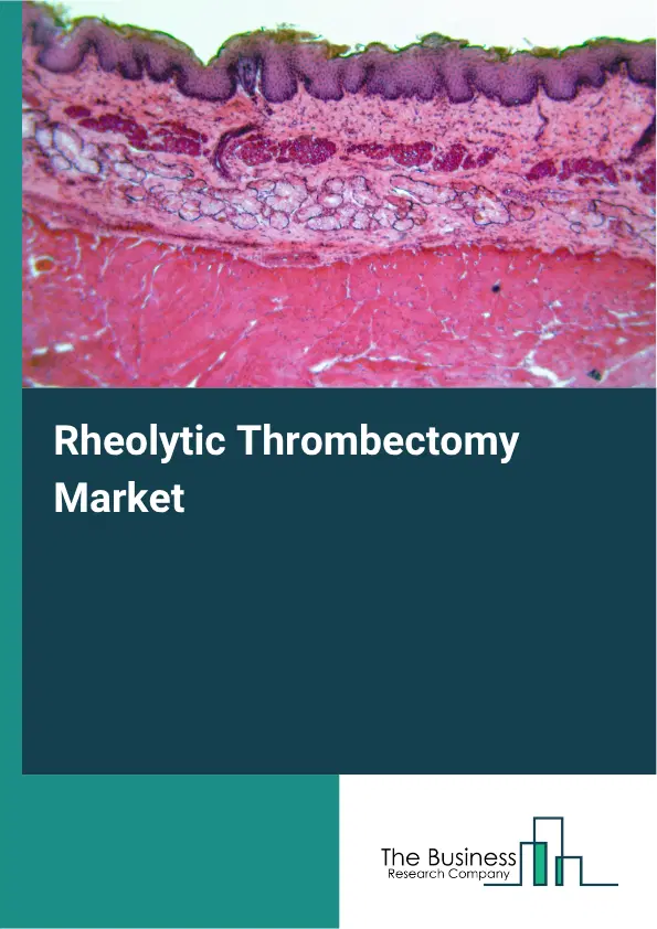 Rheolytic Thrombectomy Market Report 2026