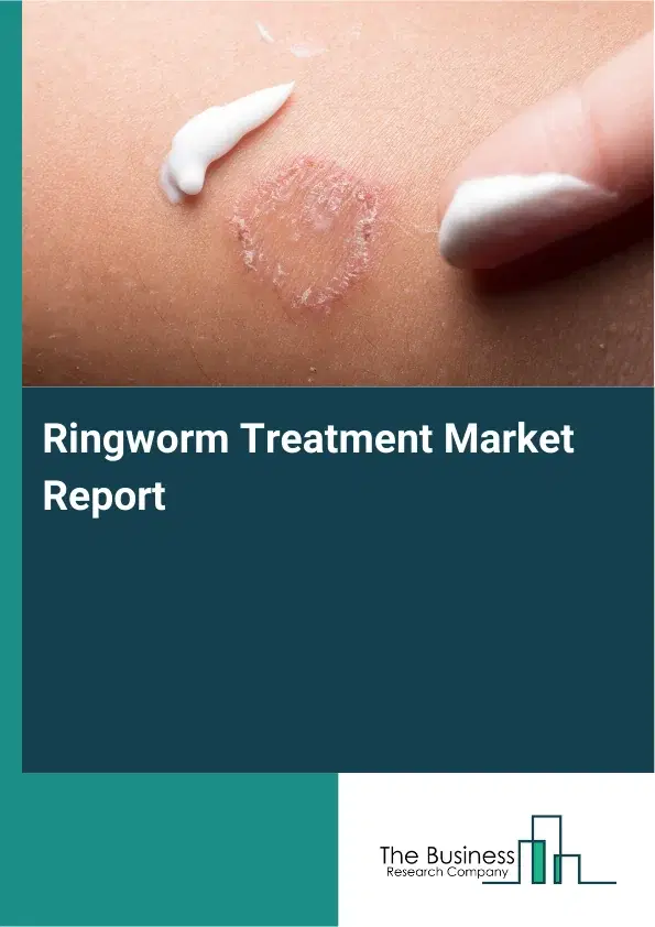 Global Ringworm Treatment Market Report 2026