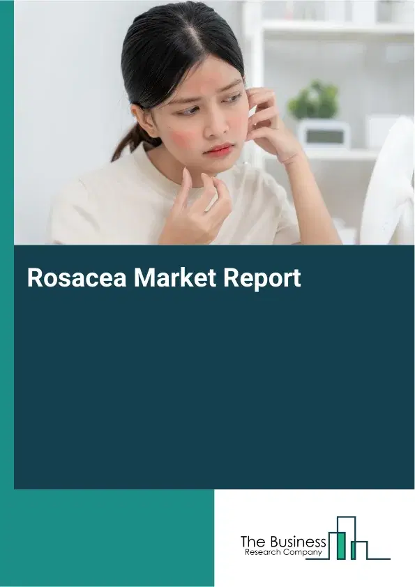 Global Rosacea Market Report 2026