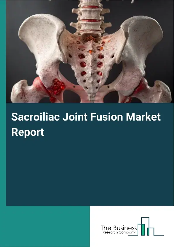 Global Sacroiliac Joint Fusion Market Report 2026