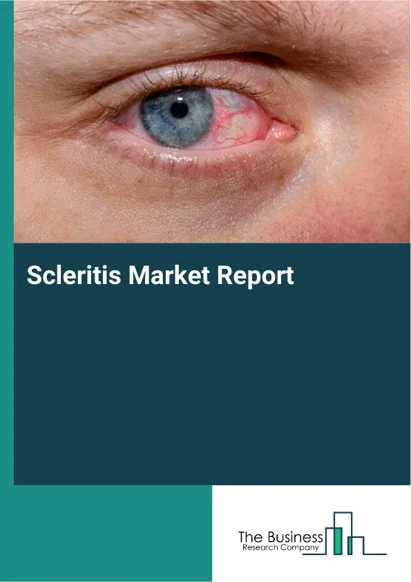 Global Scleritis Market Report 2026
