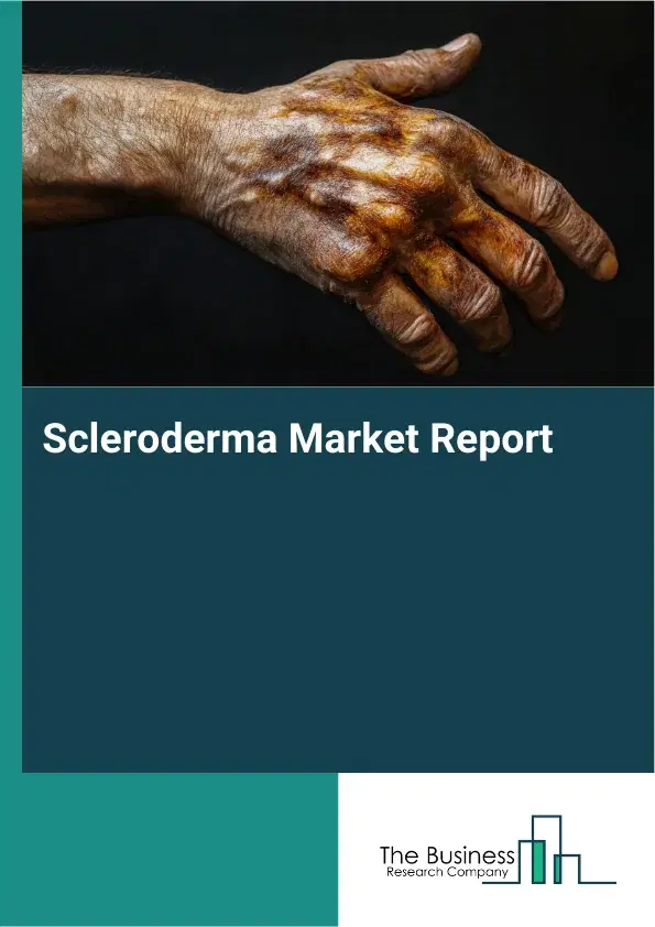 Global Scleroderma Market Report 2026
