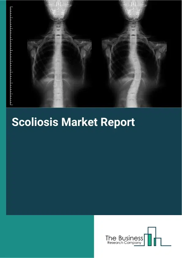 Global Scoliosis Market Report 2026