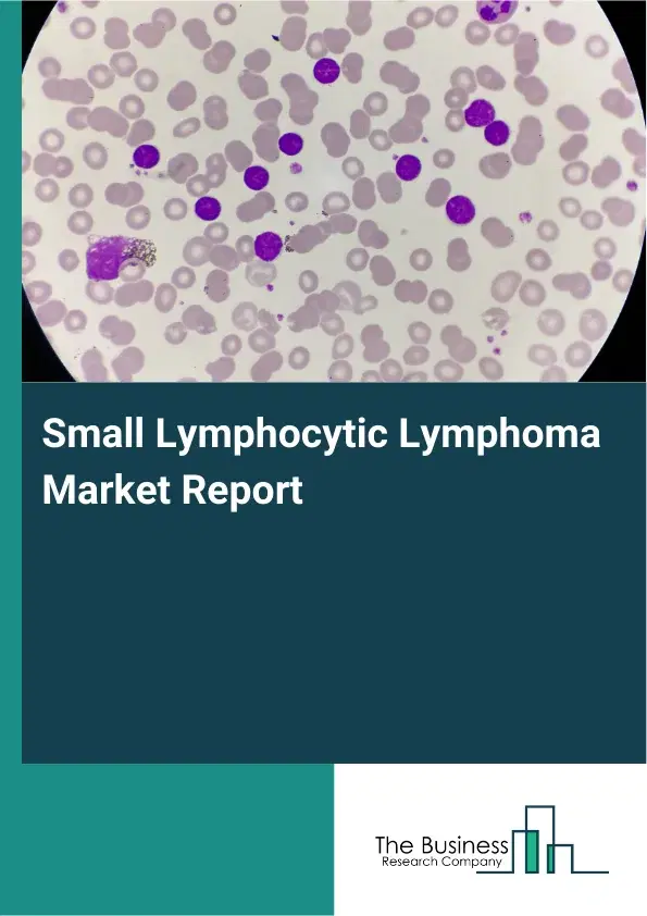 Global Small Lymphocytic Lymphoma Market Report 2026