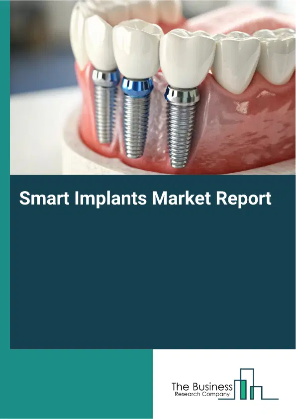 Global Smart Implants Market Report 2026