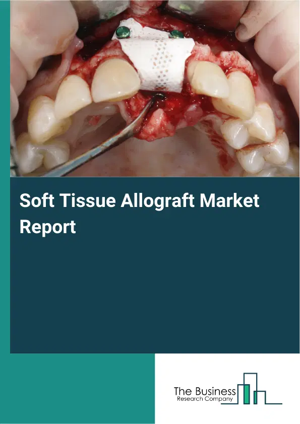 Global Soft Tissue Allograft Market Report 2026